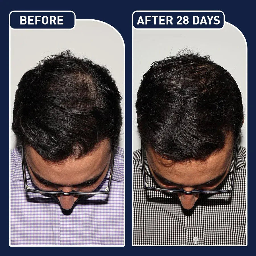 Feg Hair Serum