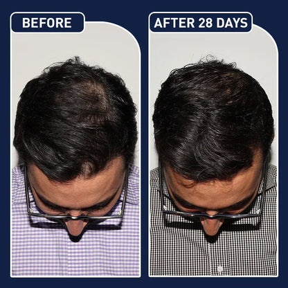 Feg Hair Serum