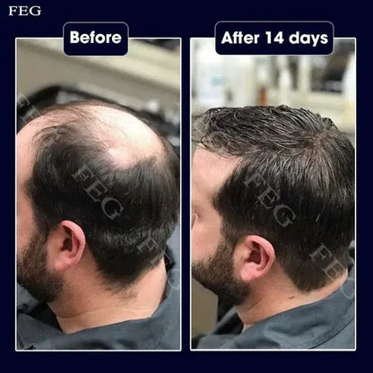 Feg Hair Serum